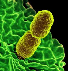 Digitally coloured scanning electron microscopic (SEM) image of two mustard coloured, rod-shaped, resistant Klebsiella pneumoniae bacteria, interacting with a green colored, human white blood cell. Credit: National Institute of Allergy and Infectious Diseases (NIAID)